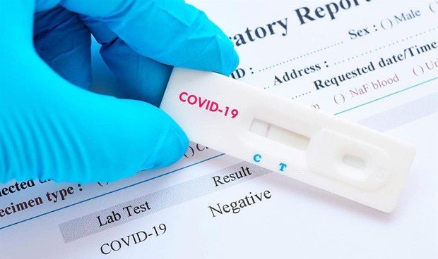 San Diegans urged not to go to emergency units for Covid tests